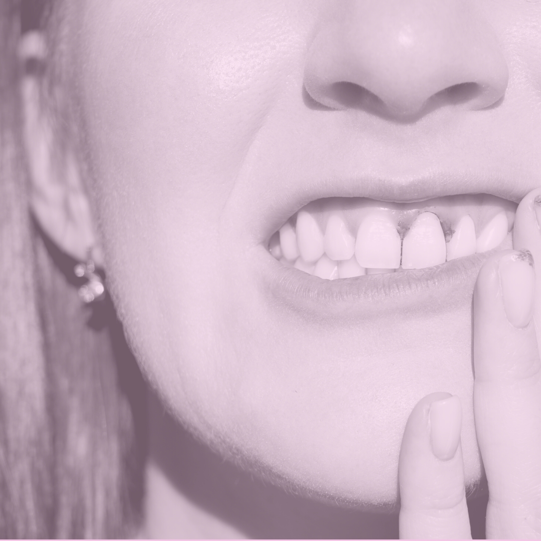 5 dudas frecuentes sobre periodontitis