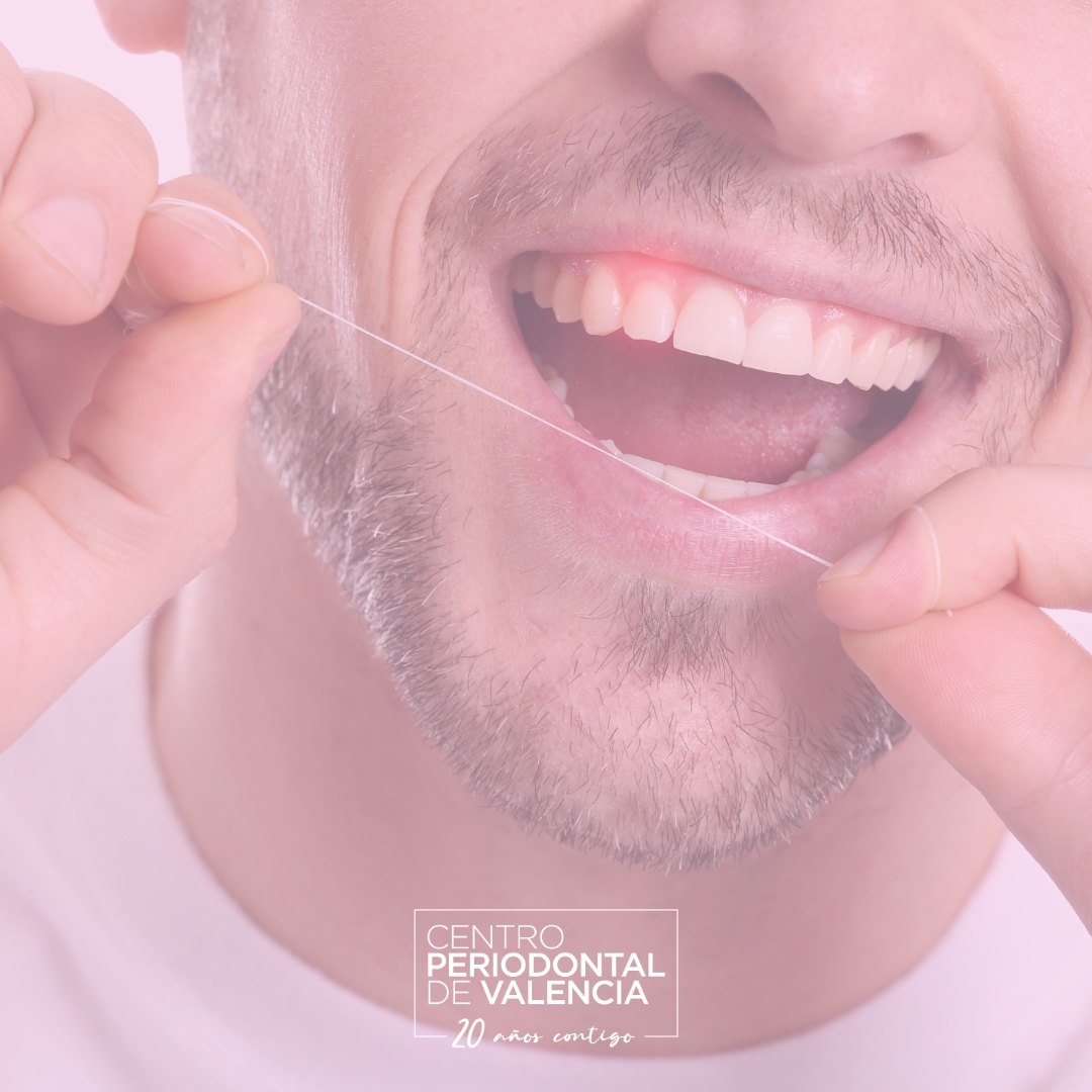Estrategias efectivas para prevenir la periodontitis